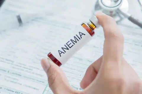 Jakie badanie krwi na anemię pomoże zrozumieć Twoje wyniki?